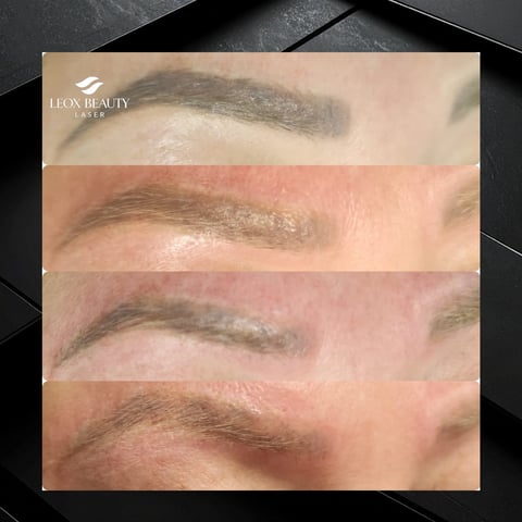 Before and after microblading eyebrow treatment showing progression of healed results across four stages